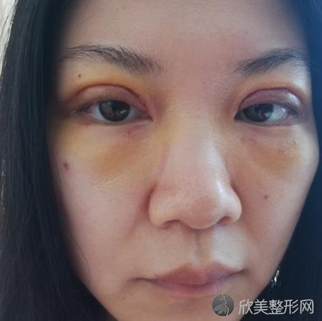 徐州市第三人民医院整形科正规嘛？抓紧看看案例介绍以信息大全就知道啦