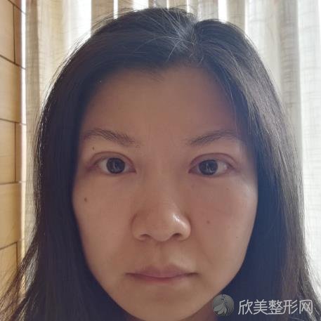 徐州市第三人民医院整形科正规嘛？抓紧看看案例介绍以信息大全就知道啦
