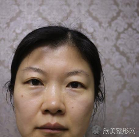 徐州市第三人民医院整形科正规嘛？抓紧看看案例介绍以信息大全就知道啦