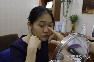杭州珠儿丽做鼻子术后恢复图来啦，让小姐姐收获了稳稳的幸福！