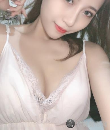 上海东方丽人假体隆胸案例-平胸妹子2个月的恢复蜕变案例来啦！