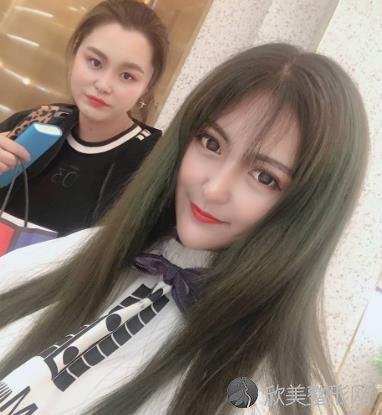 武汉美基元整形医院怎么样?双眼皮手术30天恢复效果图前后对比-价格表查询