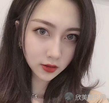 济南华夏医院激光美容科好不好？祛斑效果分享附对比照