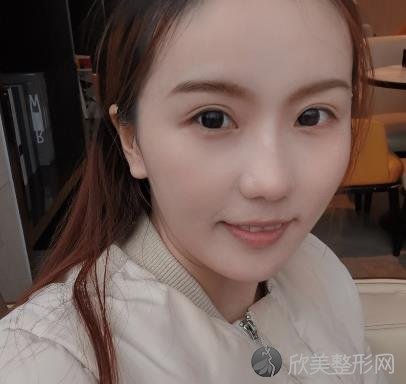 火箭军总医院整形外科做激光点痣怎么样？附手术案例+全新价格表