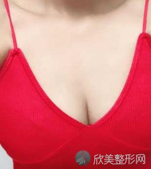 上海九院整形科价目表-曹卫刚医生自体脂肪隆胸效果如何？真实案例对比图看