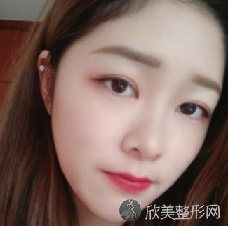 上海华美李志海磨骨怎么样？附磨骨案例分享+全新价格表