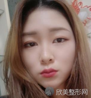 上海华美李志海磨骨怎么样？附磨骨案例分享+全新价格表