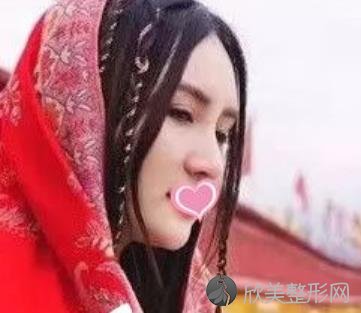 南充达芬奇整形医院怎么样?玻尿酸填充面部案例分享-价格表参考