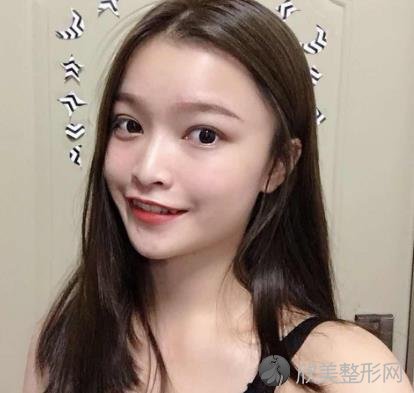 南京美莱美容医院怎么样？磨骨术前术后效果图对比，内附2021较新价格表