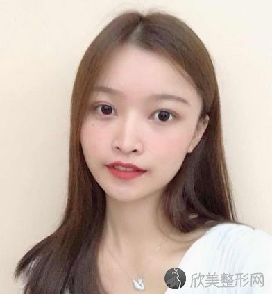 南京美莱美容医院怎么样？磨骨术前术后效果图对比，内附2021较新价格表