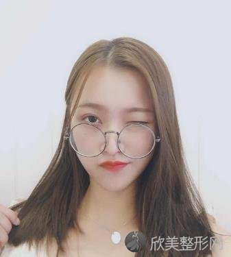 南京美莱美容医院怎么样？磨骨术前术后效果图对比，内附2021较新价格表