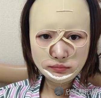 上海时光何晋龙磨骨好吗？内附何医生的相关案例介绍哦
