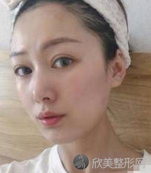 上海时光何晋龙磨骨好吗？内附何医生的相关案例介绍哦