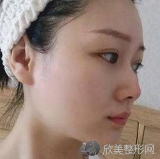 上海时光何晋龙磨骨好吗？内附何医生的相关案例介绍哦