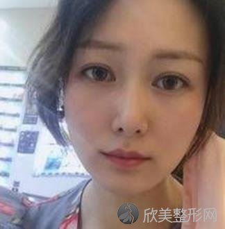 上海时光何晋龙磨骨好吗？内附何医生的相关案例介绍哦