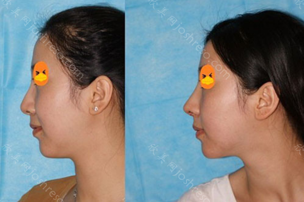 国内较好的鼻子修复专家有哪些?排名不分先后,十位专家详情一览!