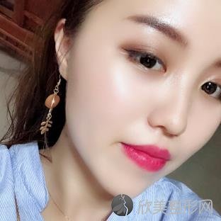 上海九院整形美容科怎么样？面部提升前后效果一览_较新价格表