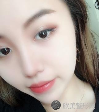 上海九院整形美容科怎么样？面部提升前后效果一览-较新价格表