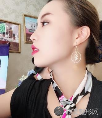 上海九院整形美容科怎么样？面部提升前后效果一览-较新价格表