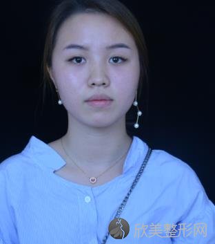 上海九院整形美容科怎么样？面部提升前后效果一览-较新价格表