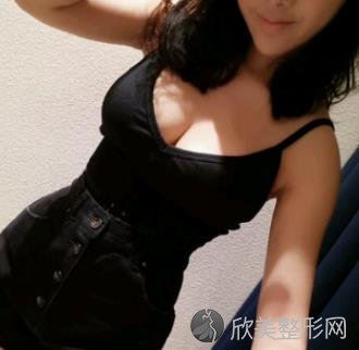 浙医二院整形科怎么样?隆胸真实效果曝光，自然柔软不影响哺乳-价格表推荐