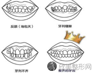 矫正牙齿去哪比较好 杭州格莱美口腔医院排名