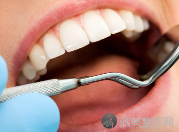 南京牙仙子口腔诊所做牙齿正畸要多少钱 牙不齐怎么矫正