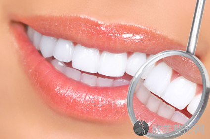 南京美奥口腔整牙价格表 种植牙的使用寿命是多久