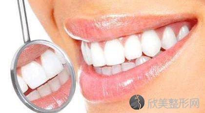 南京美奥口腔整牙价格表 种植牙的使用寿命是多久