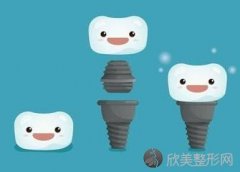 牙齿是怎么种植的 北京德贝口腔整形医院种植牙优点有哪些