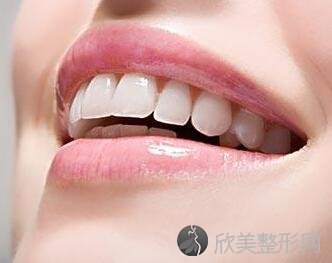 北京维尔口腔医院整形科矫正牙价格 多久能看到效果