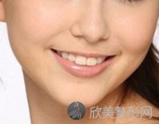 北京维尔口腔医院整形科矫正牙价格 多久能看到效果