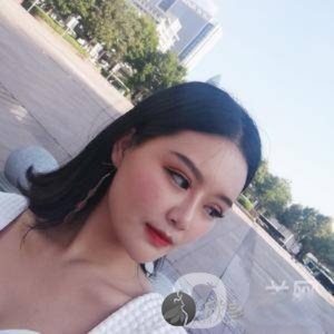 武汉中爱医疗美容吴彧昕自体脂肪填充恢复过程图分享
