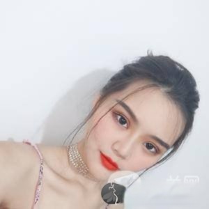武汉中爱医疗美容吴彧昕自体脂肪填充恢复过程图分享
