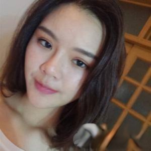 武汉中爱医疗美容吴彧昕自体脂肪填充恢复过程图分享