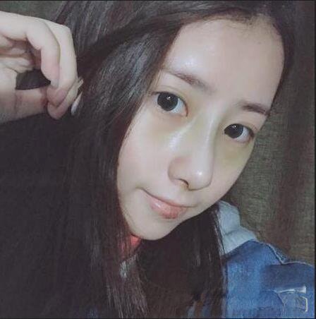 南京华美翟奔宇隆鼻恢复效果图分享
