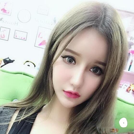 上海首尔丽格唐鏖自体脂肪填充全脸恢复记录，网红套餐整形对比