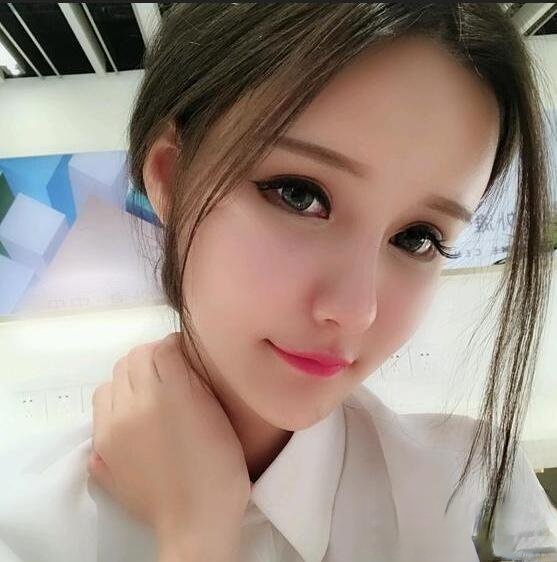 上海首尔丽格唐鏖自体脂肪填充全脸恢复记录，网红套餐整形对比