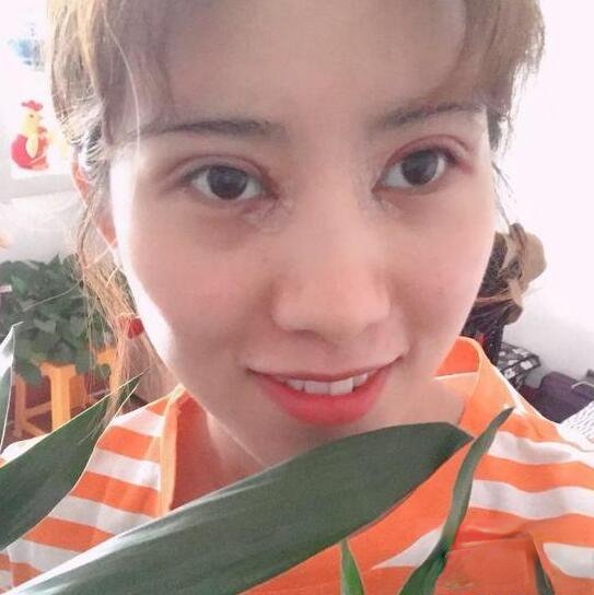济南伊美尔王清峰做全切双眼皮怎么样？附较新价格表及案例