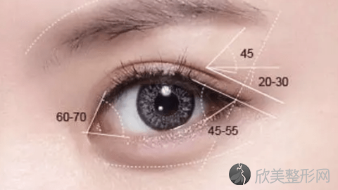 成都华西的做双眼皮的技术怎么样?成都华西双眼皮真实案例分享,术后很惊艳
