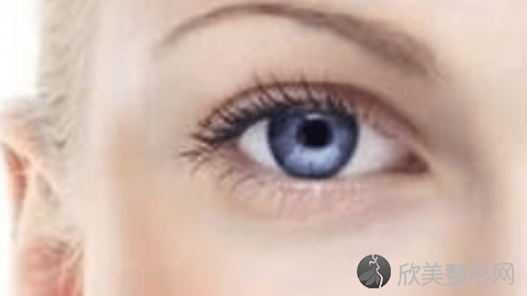 成都格莱丽做双眼皮技术技术怎么样?成都格莱丽做双眼皮真实案例,眼睛变好看