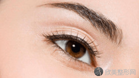 成都美极做双眼皮效果怎么样?成都美极做双眼皮案例,美眼很好看!