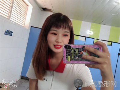 悦好医学美容医院双眼皮谁做的好？附案例-全新价格表