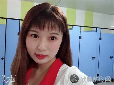 悦好医学美容医院双眼皮谁做的好？附案例-全新价格表