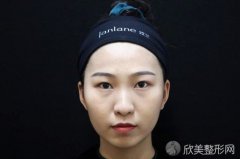 上海华美医疗美容医院是公立医院吗？附案例|全