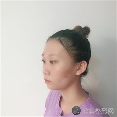 北京新面孔医疗美容诊所靠谱吗？医院案例|项目价格表较新