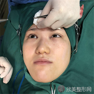 北京维嘉口腔门诊部技术如何？附案例|价格表一览