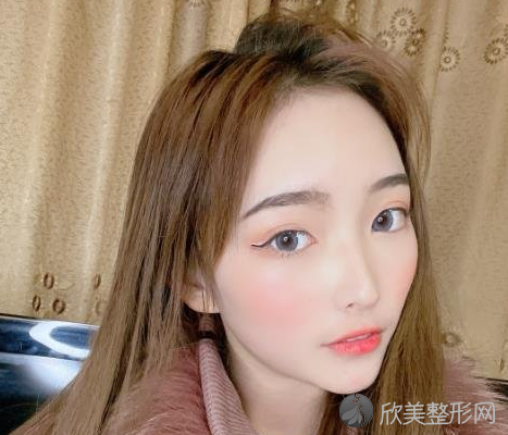 广州美恩磨骨三个月术前术后图,全新磨骨价格表