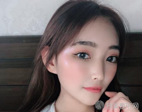 广州美恩磨骨三个月术前术后图,全新磨骨价格表