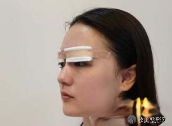上海眼修复案例